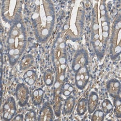 Spectrin beta 2 Antibody, Novus Biologicals:Antibodies:Primary Antibodies