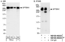 Spectrin beta 2 Antibody, Novus Biologicals 0.1mL; Unlabeled:Antibodies,