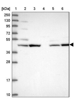 Sphingomyelin synthase 1 Antibody, Novus Biologicals:Antibodies:Primary