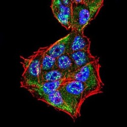 Sphingosine Kinase 2/SPHK2 Antibody (3C8D3) - BSA Free, Novus Biologicals:Antibodies:Primary