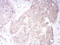 Sphingosine Kinase 2/SPHK2 Antibody (3C8D3) - BSA Free, Novus Biologicals:Antibodies:Primary