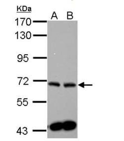 Sphingosine Kinase 2/SPHK2 Antibody, Novus Biologicals 0.1mL; Unlabeled:Antibodies,