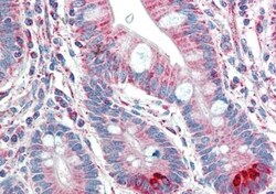 Spinesin Antibody, Novus Biologicals 0.1mg; Unlabeled:Antibodies, Polyclonal