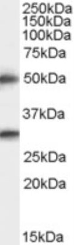 Spinesin Antibody, Novus Biologicals 0.1mg; Unlabeled:Antibodies, Polyclonal