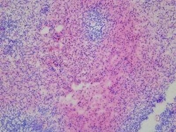 Novus Biologicals Spleen Tissue Slides (Diabetes)- Frozen 5 Slides | Buy Online | Novus Biologicals&trade; | Fisher Scientific