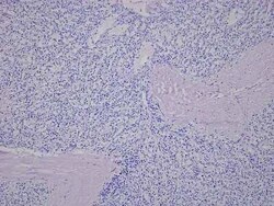 Novus Biologicals Spleen Tissue Slides (Liver Cirrhosis)- Paraffin 5 Slides | Buy Online | Novus Biologicals&trade; | Fisher Scientific