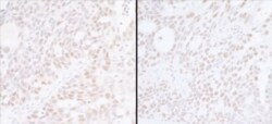 Spt6 Antibody, Novus Biologicals 0.1mL; Unlabeled:Antibodies, Polyclonal