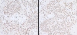 Spt6 Antibody, Novus Biologicals 0.1mL; Unlabeled:Antibodies, Polyclonal