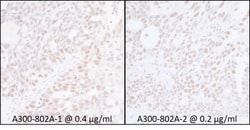 Spt6 Antibody, Novus Biologicals 0.1mL; Unlabeled:Antibodies, Polyclonal
