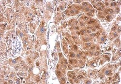 StAR Antibody, Novus Biologicals 0.1mg; Unlabeled:Antibodies, Polyclonal