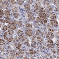 StAR Antibody, Novus Biologicals:Antibodies:Primary Antibodies
