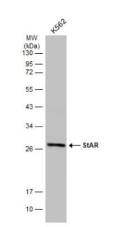 StAR Antibody, Novus Biologicals 0.1mg; Unlabeled:Antibodies, Polyclonal