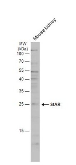 StAR Antibody, Novus Biologicals 0.1mg; Unlabeled:Antibodies, Polyclonal