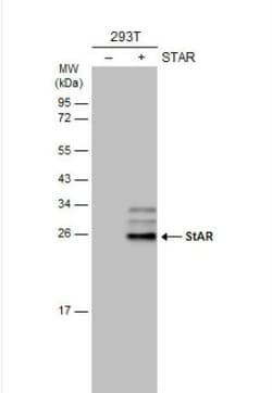 StAR Antibody, Novus Biologicals 0.1mg; Unlabeled:Antibodies, Polyclonal