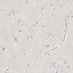 Stabilin-2 Antibody, Novus Biologicals 0.1mL; Unlabeled:Antibodies, Polyclonal