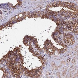 Stanniocalcin 2/STC-2 Antibody, Novus Biologicals 0.1mL; Unlabeled:Antibodies,