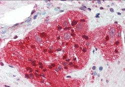 Stathmin-2/STMN2 Antibody, Novus Biologicals 0.1mg; Unlabeled:Antibodies,