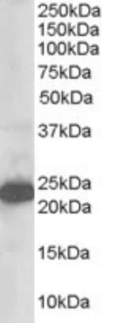 Stathmin-2/STMN2 Antibody, Novus Biologicals 0.1mg; Unlabeled:Antibodies,