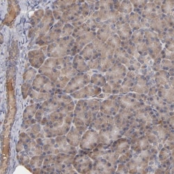 Steroid sulfatase Antibody, Novus Biologicals 0.1mL; Unlabeled:Antibodies,