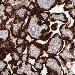 Steroid sulfatase Antibody, Novus Biologicals 0.1mL; Unlabeled:Antibodies,