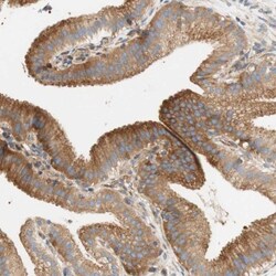 Stomatin Antibody, Novus Biologicals:Antibodies:Primary Antibodies