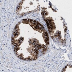 Sulfamidase/SGSH Antibody, Novus Biologicals 0.1mL; Unlabeled:Antibodies,