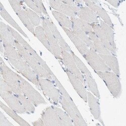 Sulfamidase/SGSH Antibody, Novus Biologicals 0.1mL; Unlabeled:Antibodies,