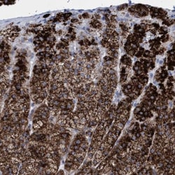 Sulfamidase/SGSH Antibody, Novus Biologicals 25 &mu;L; Unlabeled:Antibodies,