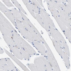 Sulfamidase/SGSH Antibody, Novus Biologicals 25 &mu;L; Unlabeled:Antibodies,