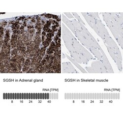 Sulfamidase/SGSH Antibody, Novus Biologicals 25 &mu;L; Unlabeled:Antibodies,