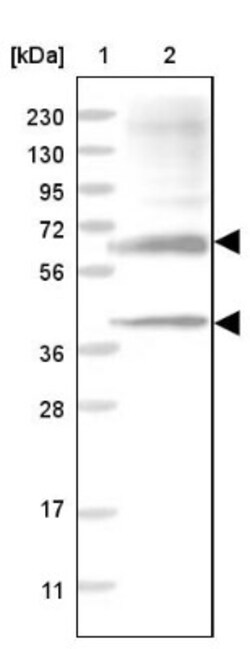 Sulfamidase/SGSH Antibody, Novus Biologicals 0.1mL; Unlabeled:Antibodies,