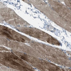 Supervillin Antibody, Novus Biologicals 0.1mL; Unlabeled:Antibodies, Polyclonal