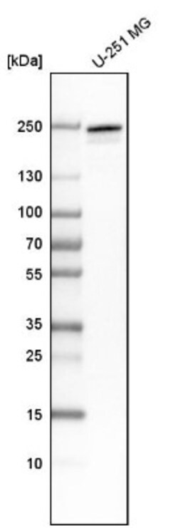 Supervillin Antibody, Novus Biologicals 0.1mL; Unlabeled:Antibodies, Polyclonal