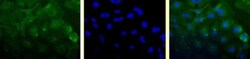 Survivin Antibody (60.11) - Unpurified, Novus Biologicals 0.1mL; Unlabeled:Antibodies,