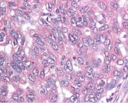 Survivin Antibody (60.11) - Unpurified, Novus Biologicals 0.1mL; Unlabeled:Antibodies,