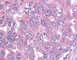 Survivin Antibody (60.11) - BSA Free, Novus Biologicals 0.1mL; Unlabeled:Antibodies,