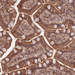 Symplekin Antibody, Novus Biologicals:Antibodies:Primary Antibodies
