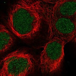 SynGAP Antibody, Novus Biologicals 0.1mL; Unlabeled:Antibodies, Polyclonal