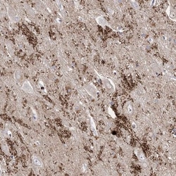 SynGAP Antibody, Novus Biologicals 0.1mL; Unlabeled:Antibodies, Polyclonal