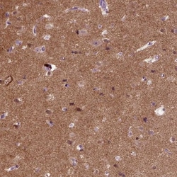 SynGAP Antibody, Novus Biologicals 0.1mL; Unlabeled:Antibodies, Polyclonal