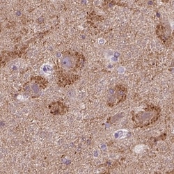 SynGAP Antibody, Novus Biologicals 0.1mL; Unlabeled:Antibodies, Polyclonal