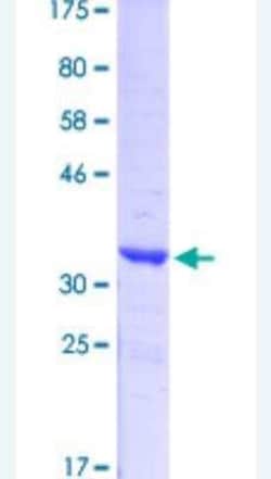 Novus Biologicals Recombinant Human Synapsin I GST (N-Term) Protein 10 &mu;g | Buy Online | Novus Biologicals&trade; | Fisher Scientific