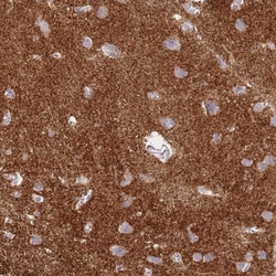 Synaptogyrin 3 Antibody, Novus Biologicals 0.1mL; Unlabeled:Antibodies