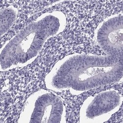 Synaptogyrin 4 Antibody, Novus Biologicals 0.1 mL | Buy Online | Novus Biologicals | Fisher Scientific