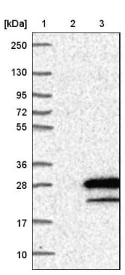 Synaptogyrin 4 Antibody, Novus Biologicals 0.1 mL | Buy Online | Novus Biologicals | Fisher Scientific