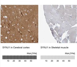 Synaptojanin 1 Antibody, Novus Biologicals:Antibodies:Primary Antibodies