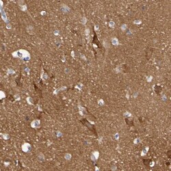 Synaptojanin 1 Antibody, Novus Biologicals:Antibodies:Primary Antibodies