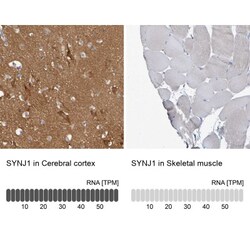Synaptojanin 1 Antibody, Novus Biologicals:Antibodies:Primary Antibodies