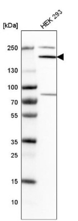 Synaptojanin 1 Antibody, Novus Biologicals:Antibodies:Primary Antibodies