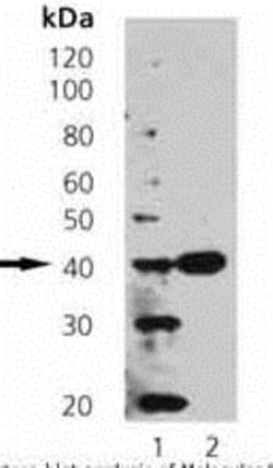 Synaptophysin Antibody (EP10), Novus Biologicals:Antibodies:Primary Antibodies